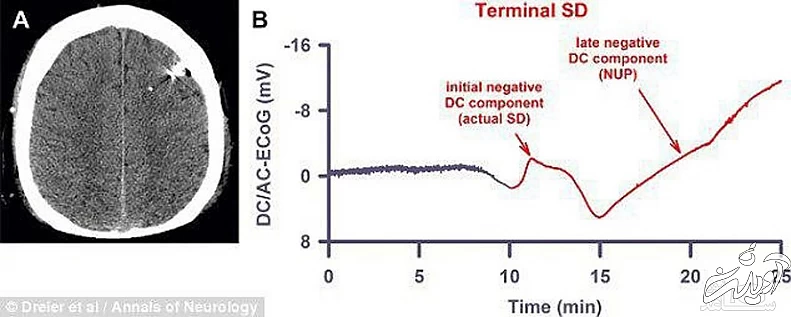 زنده کردن مرده پس از مرگ